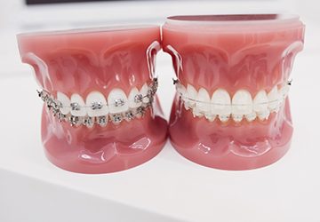 faze ortodontske terapije