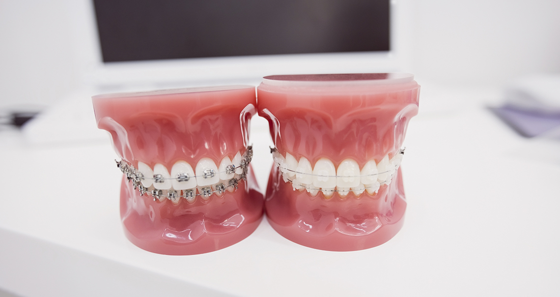 ortodoncija 2